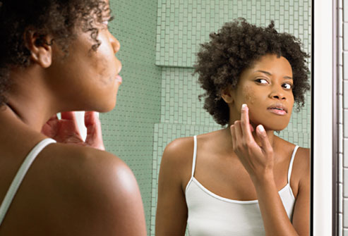 acne pimples skin