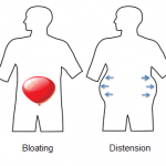 bloating and distention