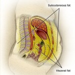 visceralfat